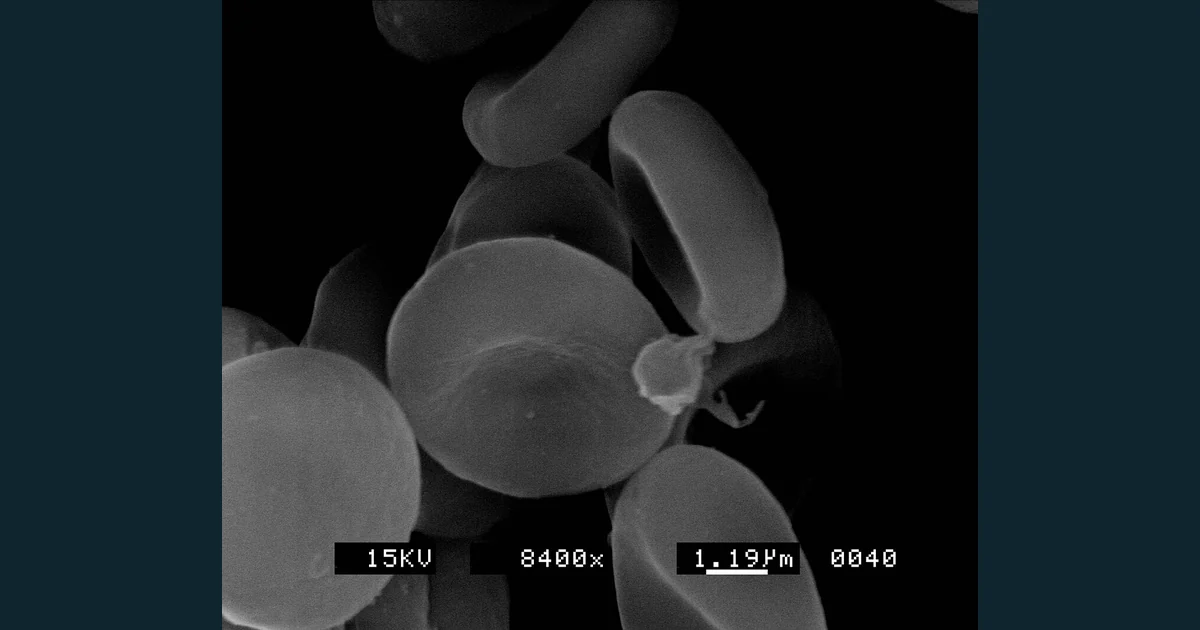 Micrografie electronică a unor eritrocite, cu discuri biconcave vizibile