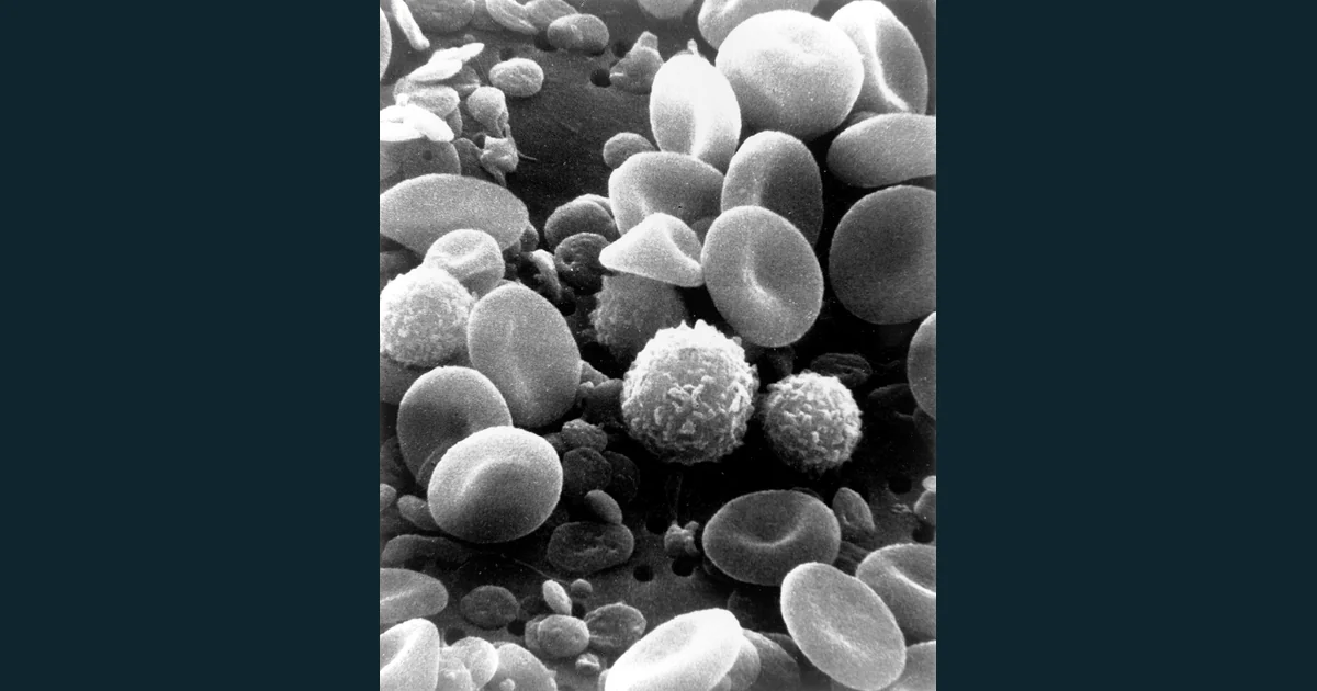 Micrografie electronică cu eritrocite, o celulă albă și trombocite de dimensiuni mai mici